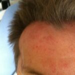 A few bumps